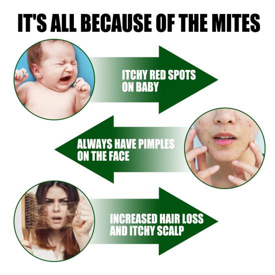 100 г насадка дизайн пылевой клещ убийца безвредный практичный зеленый колючий зола удаляющий спрей