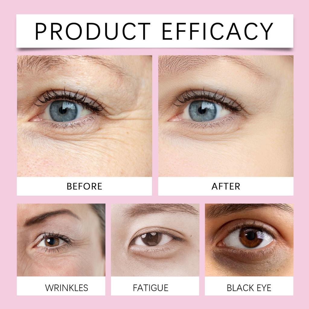 Многофункциональный шарик масла для глаз Light Lines Compact Anti-aging Увлажняющий Устранение морщин Устранение черных мешков под глазами Массажный уход 10 мл