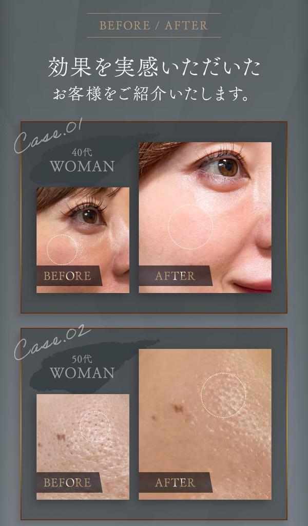 UMBILICAL Premium Aging Care Serum Human Stem Cell Serum Purely Domestic Human Cord Blood Cell Conditioning Culture Solution Contains High Exosome