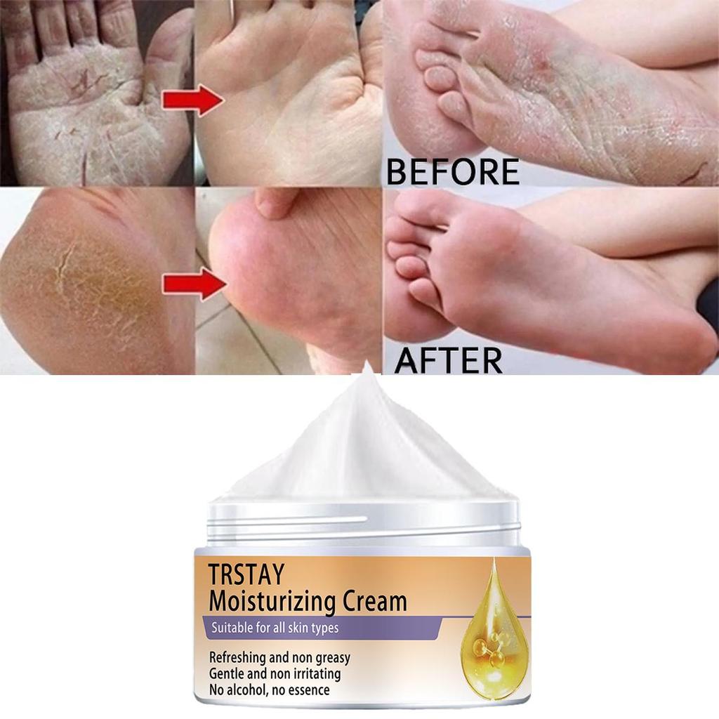 Увлажнитель для ног осветляет тон кожи, увлажняет, осветляет тусклость и укрепляет кожу