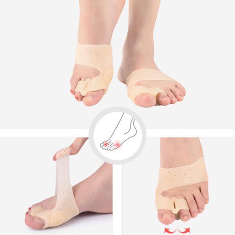 Набор для коррекции вальгусной деформации большого пальца с двойным отверстием, сепаратор для пальцев передней части стопы, устройство для коррекции большой кости стопы