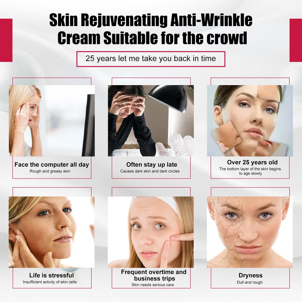 EELHOE Крем для лица для удаления морщин, 5 секунд, лифтинг, укрепляющий, против старения, выцветания, отечности, тонких линий, увлажняющий крем для ухода за кожей, 30 г