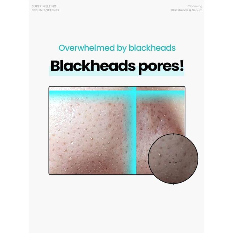 ilso Специальный набор Super Melting Sebum Softener