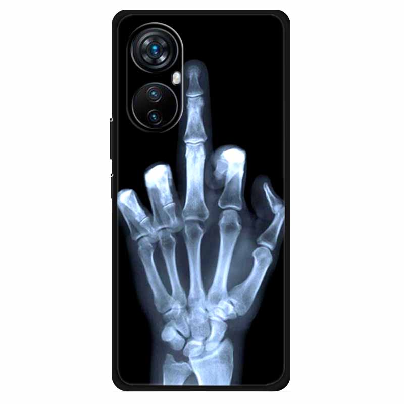 Чехол для Blackview A200 Pro Модный Силиконовый Черный Окрашенный ТПУ Мягкий Чехол для Телефона для Blackview A 200 Pro 6.67 Защитный A200Pro