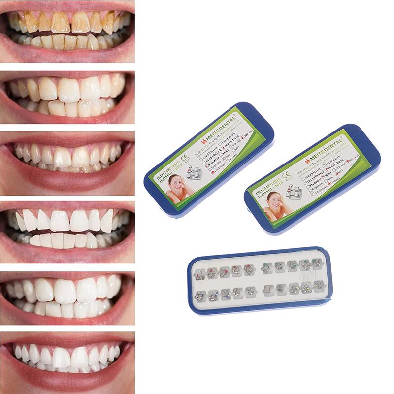 Высококачественные стоматологические брекеты Материал пассивные самолигирующие брекеты Mbt/Roth 022 345 Крючки