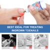 Toenail Fungus Care Solution, FastActing Nail Care Solution for Fungus Under & Around Restores The Healthy Appearance of Nails