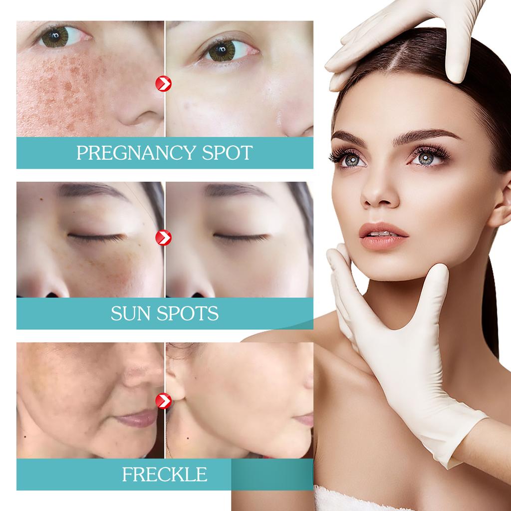 Ниацинамидная сыворотка для кожи, увядающая, пигментация, сужение пор, увлажнение, уход за кожей против морщин