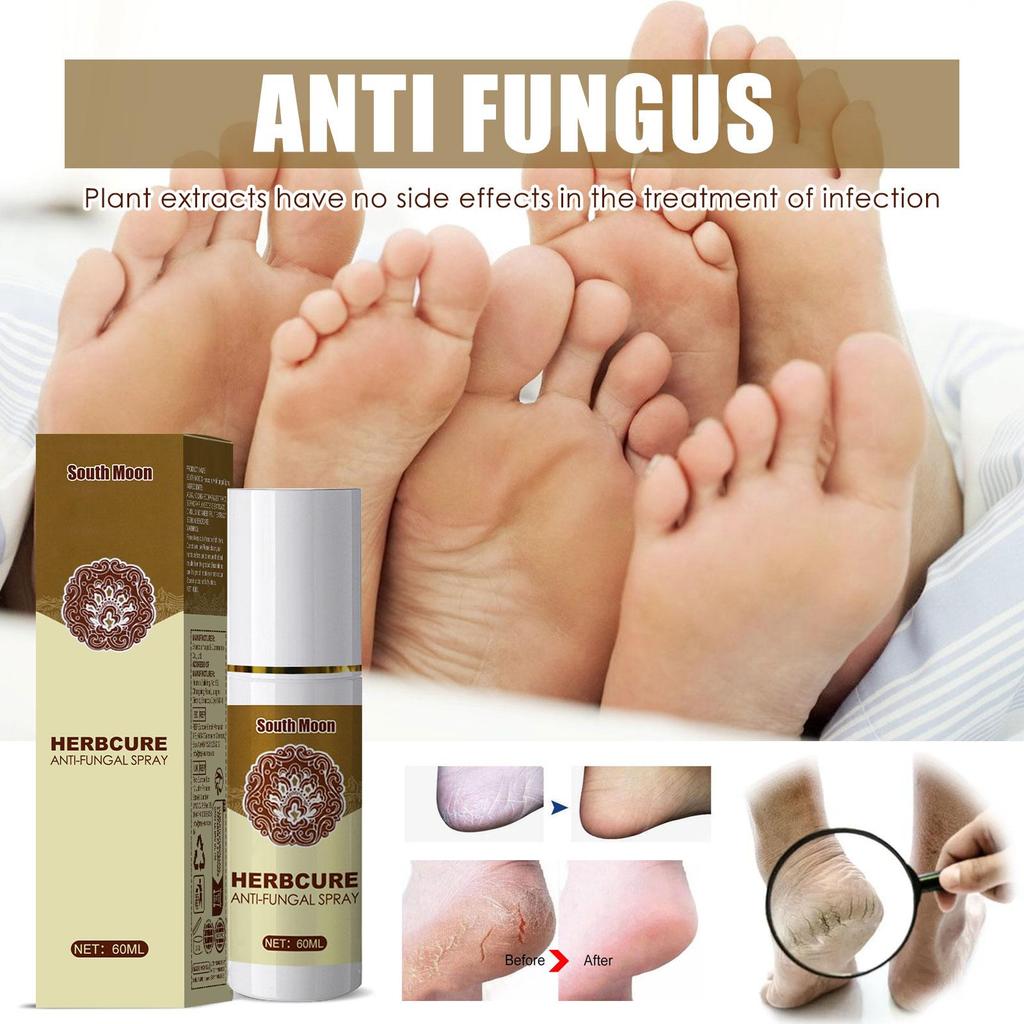 South Moon Herbal Foot Mist Foot Skin Moisturizer Hydration Anti-Cracking Skin Mild Conditioner
