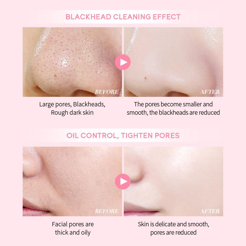 LAIKOU Маска с вишневым цветом, 75 г. Грязевая маска мазкового типа для очистки пор. Уход за кожей. Увлажнение и увлажнение.