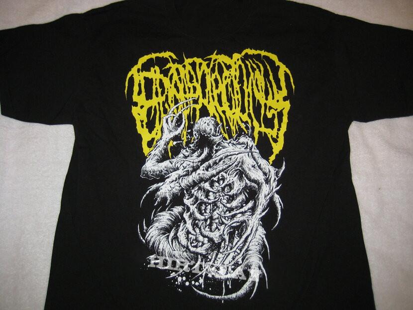 Collection Epicardiectomy Band Tour All Size S to 5XL Unisex T-shirt MD129 Unisex T-Shirt
