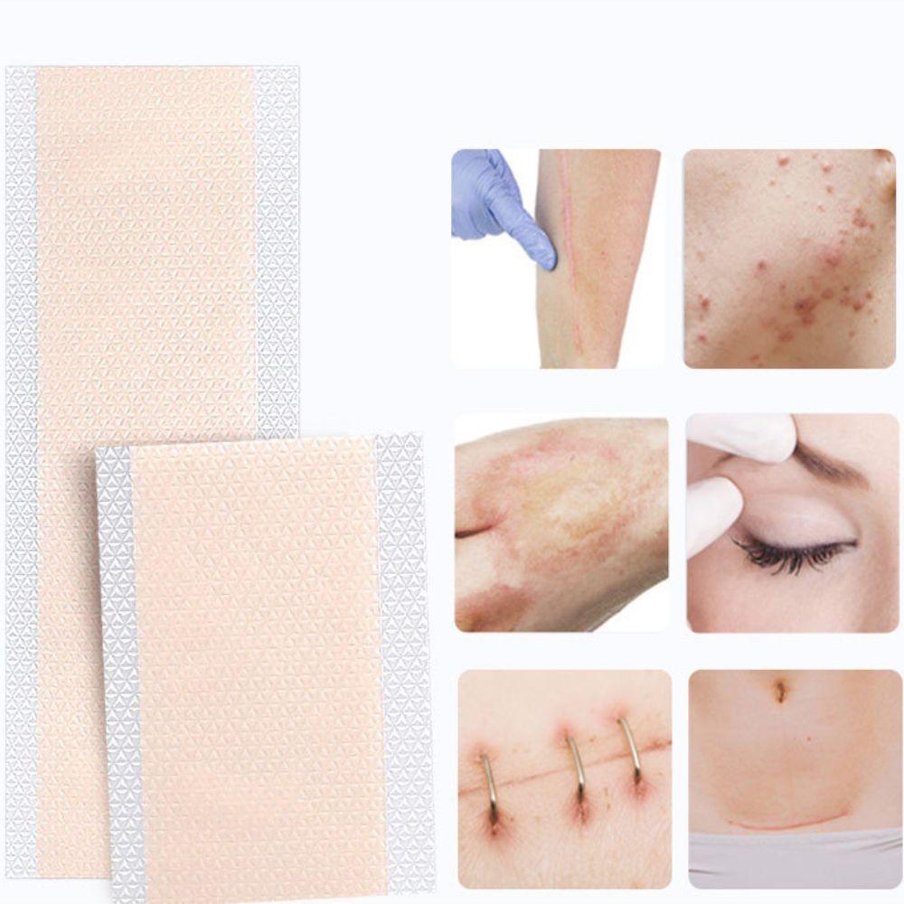 Ultra-thin Scar Flaw Concealing Tapes Waterproof Tattoo Cover Up Sticker Birthmark