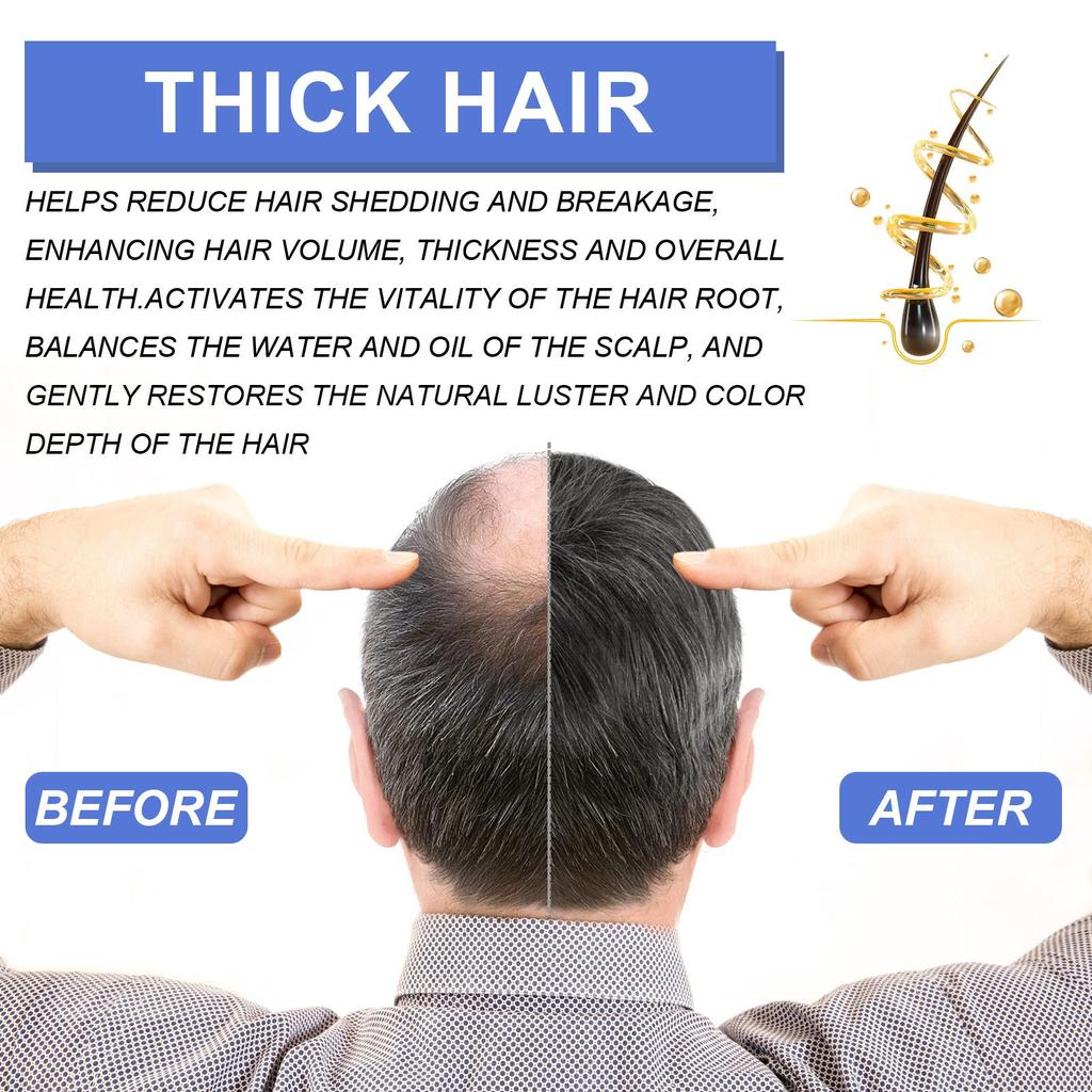 Hair Growth Foam Infused With Biotin Super Powerful Hair Growth To Make Hair Longer And Thicker,60ML