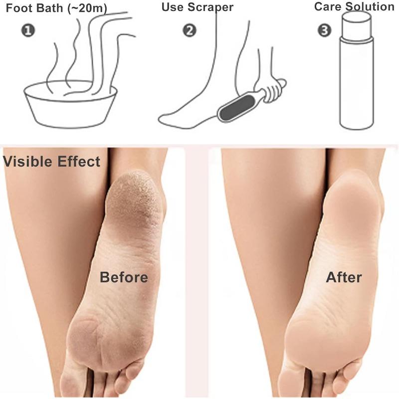 Double Sided Sanding And Rubbing Foot Board Remove Dead Skin Calluses Keratin Brush Heel Scrape Polish Foots-Grinding-Board File