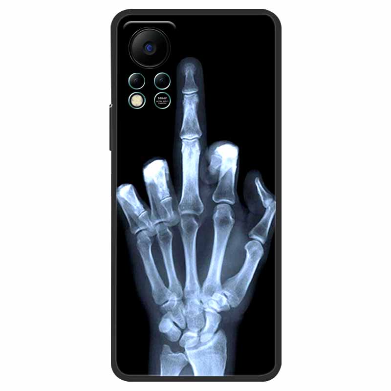 Для Infinix HOT 11S NFC Чехол X6812B Модный Мягкий ТПУ Силиконовый Чехол для Телефона Для Infinix HOT11S NFC Задняя Крышка HOT 11 S 6.78 Funda