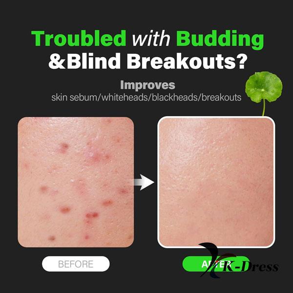 FATION NOSCA9 Trouble Serum S 30ml