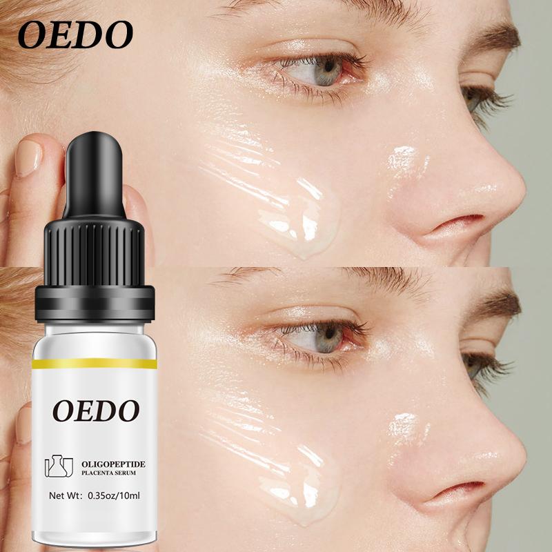 Oligopeptide Placenta Serum Face Cream Acne Treatment Skin Care Repair Whitening Anti Anging Winkles Essence Moisturizing