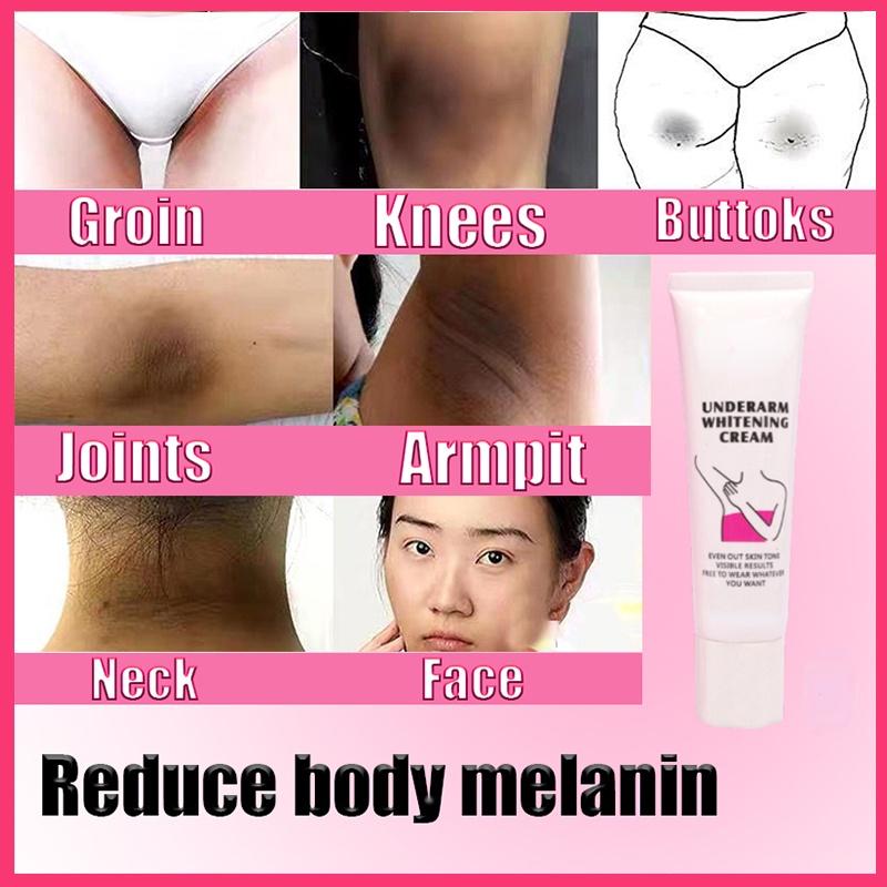 Отбеливающий крем для отдельных частей тела, отбеливающий крем для рук, бедер, тела, коленей, отбеливающий, осветляет кожу, мягкий, не раздражает