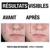 Neutrogena Anti-Boutons + Gel Nettoyant Visage Peaux à Tendance Acnéique 200ml