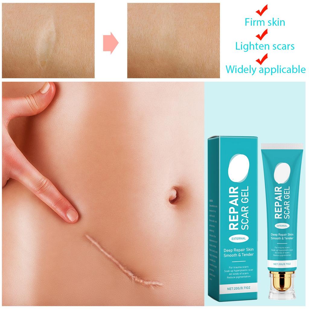 Крем от шрамов, крем для удаления шрамов для мужчин и женщин, разглаживание кожи, укрепление и исчезновение, глубокое разглаживание кожи, нежное внешнее воздействие всех видов