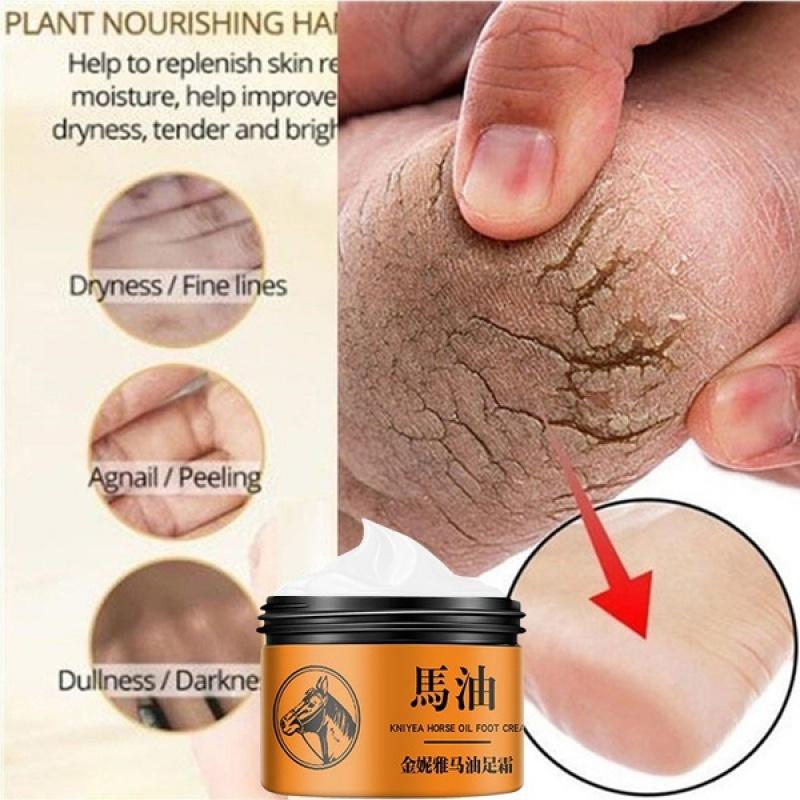 Horse Oil Hand and Foot Repair Cream Foot Cream Care Cream Beriberi and Itchy Feet Blisters Prevent Chapped