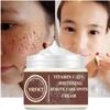 Women New Skin Brightening Cream&Freckle Cream&Dark Spot Corrector Remover for Face Blemishes