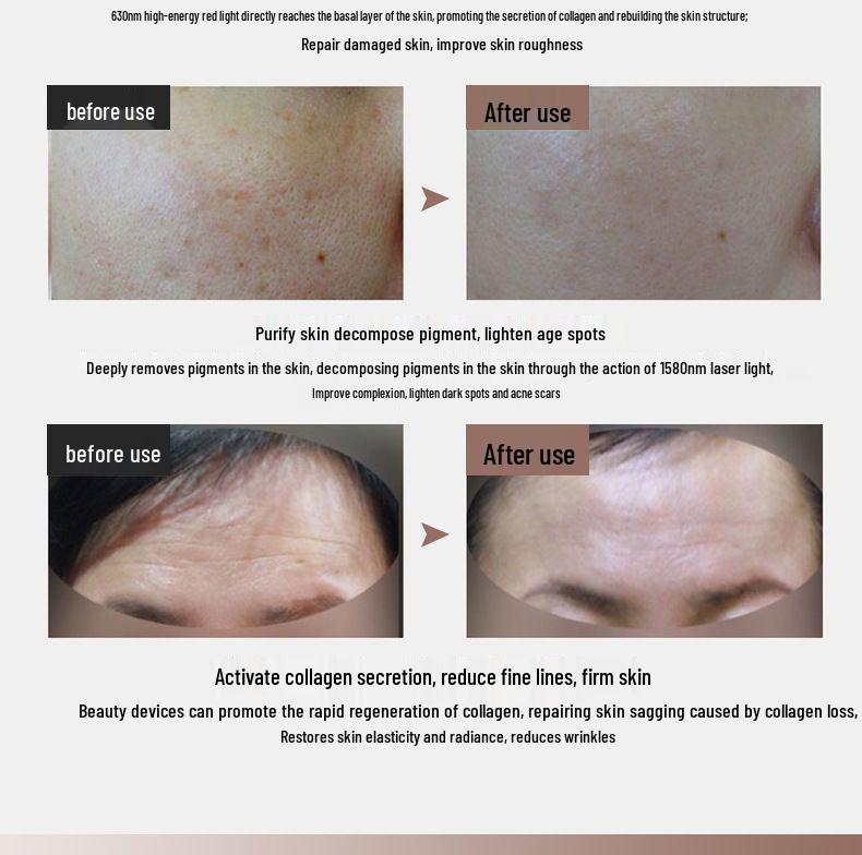 Светодиодная маска для лица для фотоомоложения - Домашнее отбеливающее и косметическое устройство