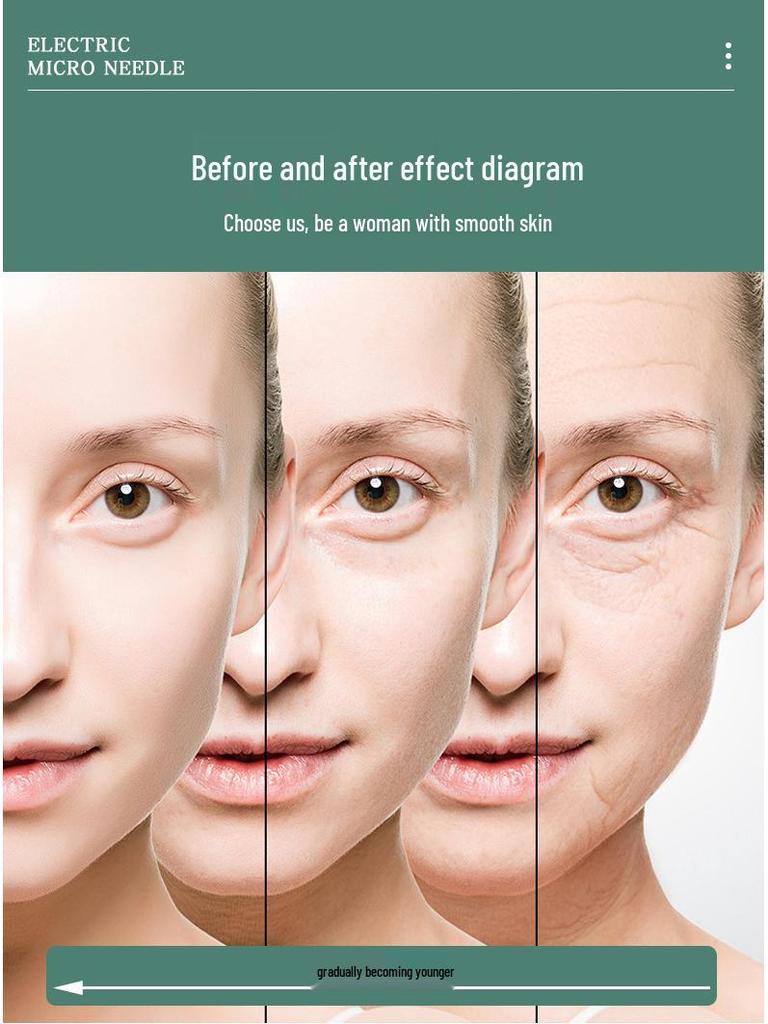 Beauty Gold 20-игольчатый микроигольчатый штамп и водорастворимые иглы - Портативный ручной пресс