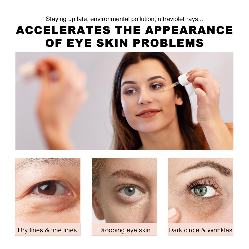 Крем для глаз с ретинолом, разглаживает мелкие морщинки вокруг глаз, убирает мешки под глазами, черные круги, подтягивает и увлажняет кожу вокруг глаз, 30 мл