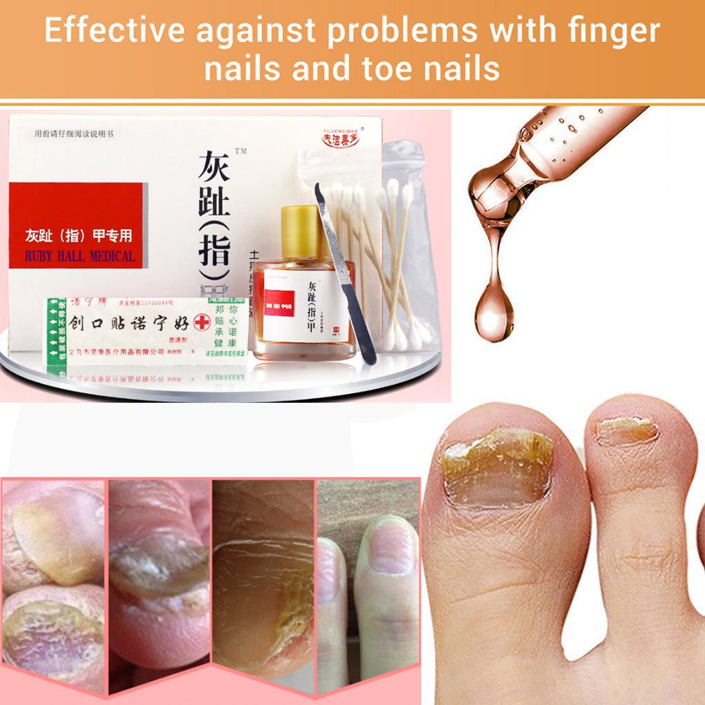 Инструменты для ногтей Инструменты для ногтей Fashion Nail Repair Essence Увлажнение Art Care Питание для сухой потрескавшейся кутикулы Уход за ногтями Инструменты для ногтей