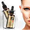 Scar Removal Serum Stretch Marks Postoperative Scar And Burns Repair Skin Repair