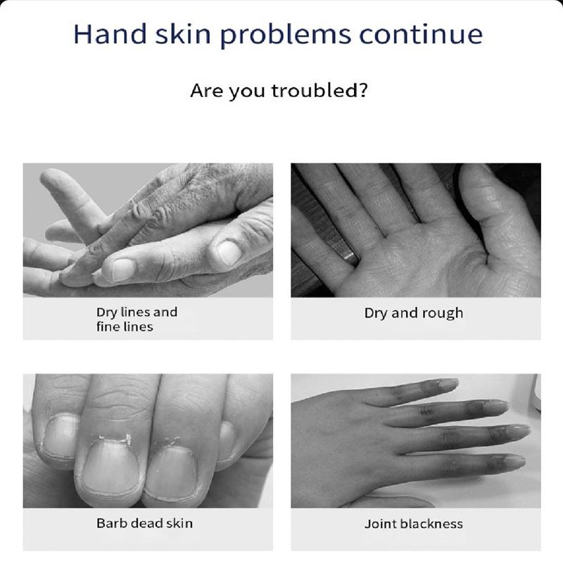 Мягкая маска для рук с ниацинамидом Увлажняющая, отшелушивающая, предотвращающая высыхание рук Маска для рук Уход за руками