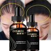 Anti Alopecia Hair Growth Serum Essential Oil Anti Hair Loss Spray Products Ginger Treatment Dry Frizzy Damaged
