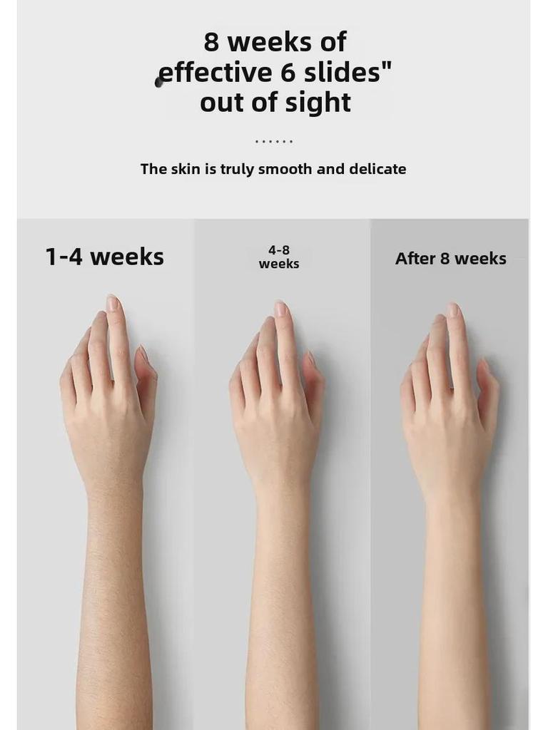 Portable IPL Laser Hair Removal Device for Whole Body and Underarm