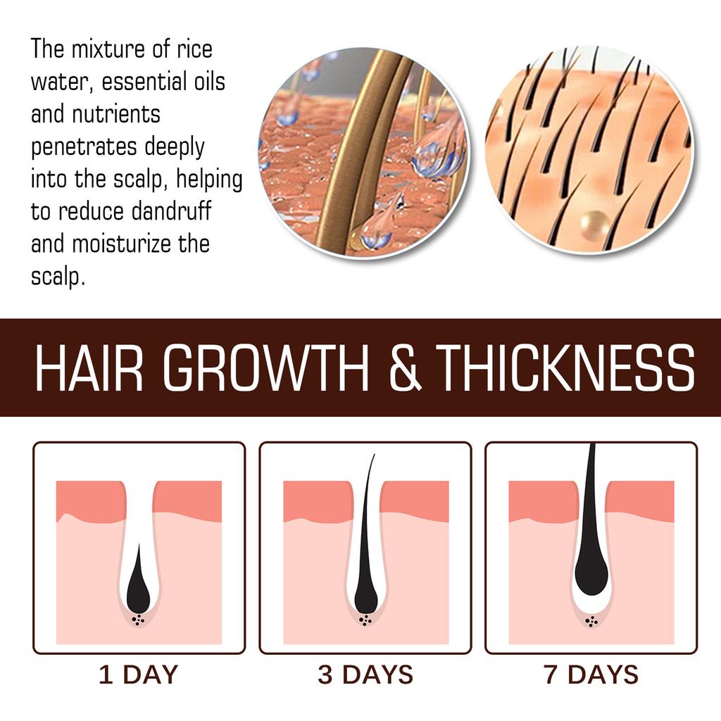 Eelhoe Сыворотка с ферментированной рисовой водой, натуральная нежная рисовая вода, эссенция для волос с ферментированной рисовой водой, сыворотка для роста волос для истонченных волос, 60 мл