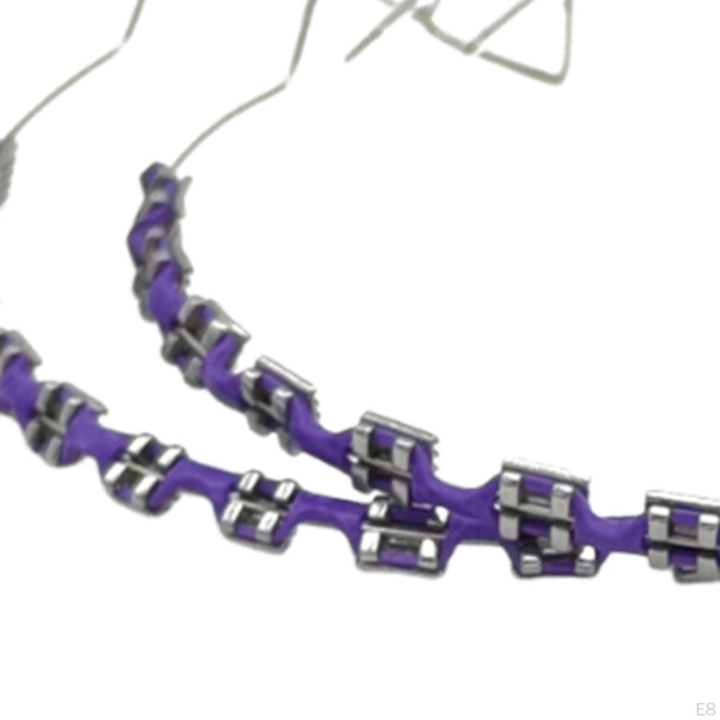 Временное украшение для зубов, практическое применение, металлические скобки для студентов