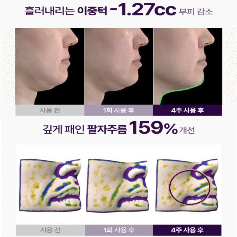 Meditherapy Inmotox Tension Up Mask 5 шт. / 10 шт.