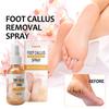 Спрей для ног для очистки омертвевшей кожи, кутина, мозолей, предотвращения сухости, трещин и увлажнения кожи.