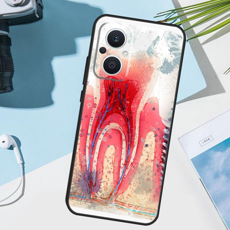 Чехол-обложка с анатомией человеческого зуба для OPPO Reno 14F 13F 12F 11F 8T 7 8 Lite 10 11 12 13 14 OPPO Find X9 X8 X5 X6 Pro