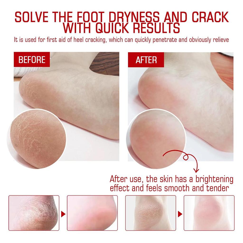 Питательный набор масок для рук и ног с увлажняющим кремом для ног для гладкой и сияющей кожи