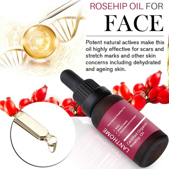 Lanthome увлажняющая эссенция для восстановления темных пятен и шрамов, осветляющая средство для удаления растяжек