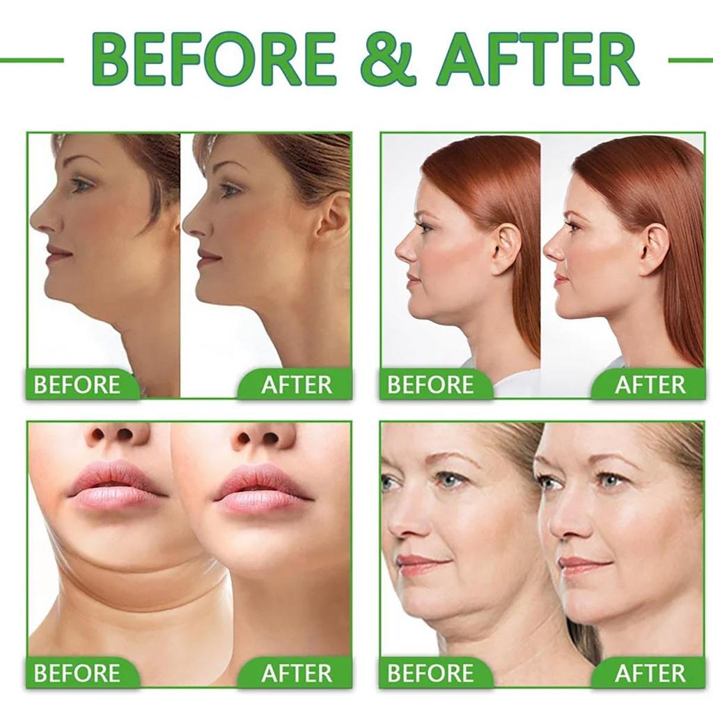 Крем для шеи для осветления линий шеи, поддержания гладкости шеи, против старения.: осветлить тон кожи, увлажнить, укрепить, смягчить кожу