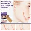 Eelhoe Silicone Scar Patches For Reducing Pregnancy And C-section Scars Effectively