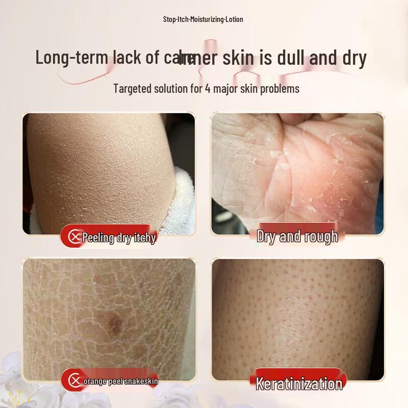 BEAUTY NOTES Увлажняющий лосьон для тела против зуда