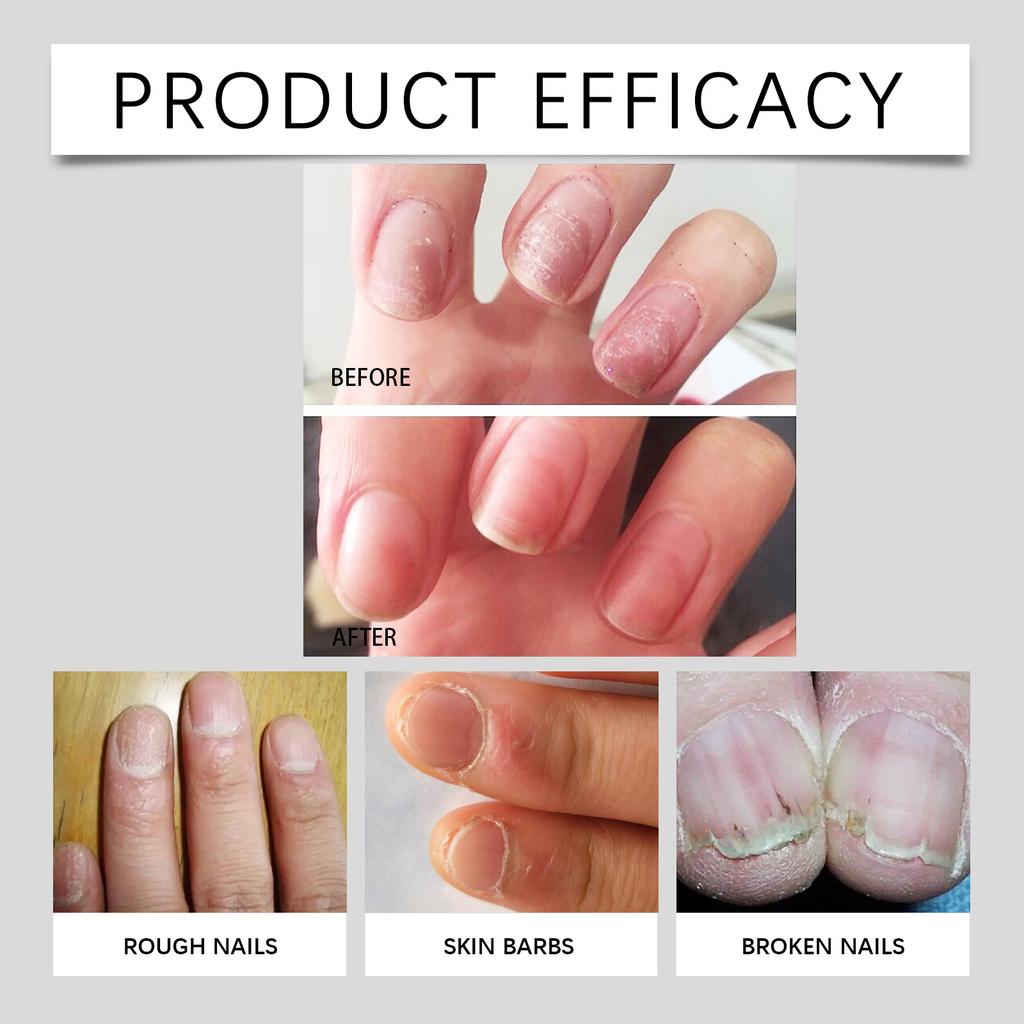 Transparent Nourishing Nutrient Pen For Nail Care  Nourishing Oil For Nail Edge  Preventing Dead Skin And Barbed Nails 2ML