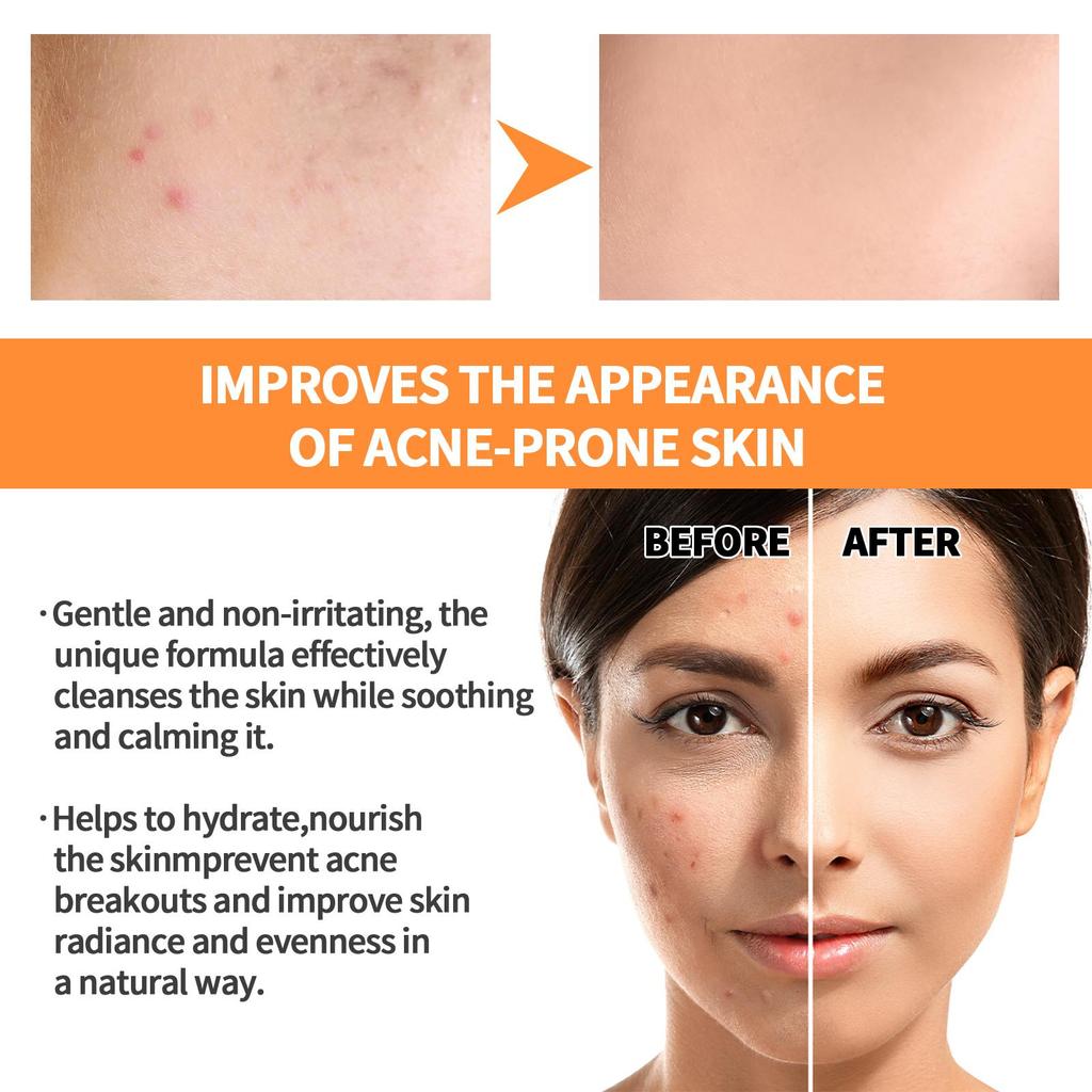 EELHOE Turmeric Mud Mask Stick Anti-Acne Pore Cleansing Solid Mask