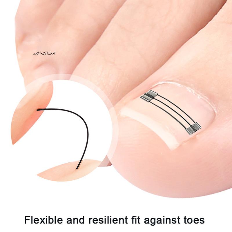 1 комплект Профессиональный корректор для вросшего ногтя, клипса, скоба, педикюрный инструмент для восстановления ногтя на ноге, инструмент для выпрямления вросшего ногтя