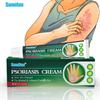 Herbal Ointment Anti-itch Skin Care Plaster Gently Nourishes The Skin of Hands and Feet and Smoothes The Skin