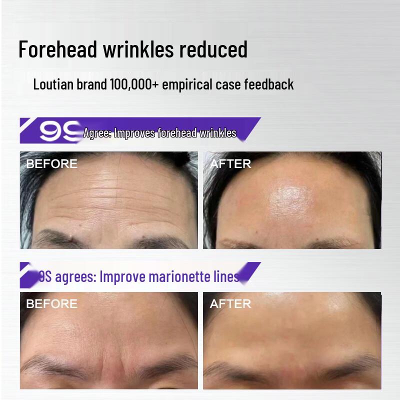 Peach Blossom Frown Line & Forehead Patch
