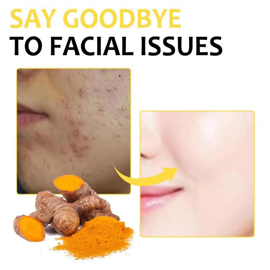 Cleansing Pads, Kojic Cleansing Pads Helps Balance Skin Oil And Water Hydrating Remove Excess Keratin From The Body'S Skin(50PC/30ml