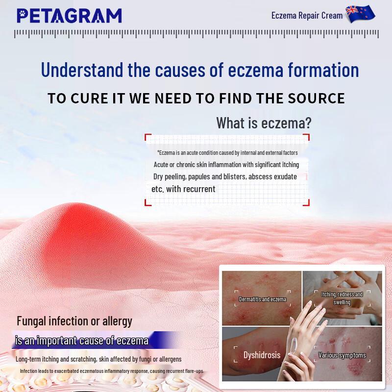 PETAGRAM Eczema and Anti-Itch Cream
